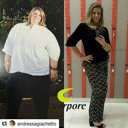 Antes e depois da Andressa que conseguiu emagrecer 106kg